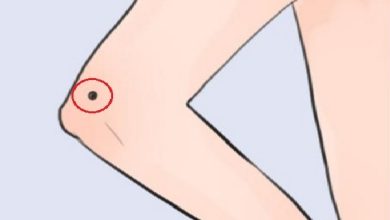 Người có nốt ruồi ở khuỷu tay thường có tướng số thế nào? 1838166992